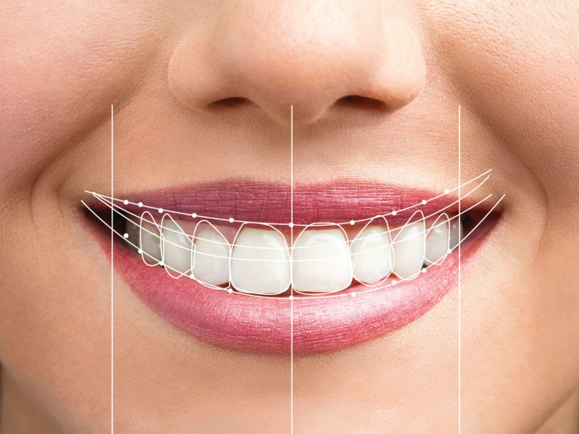 Dental-smile-design